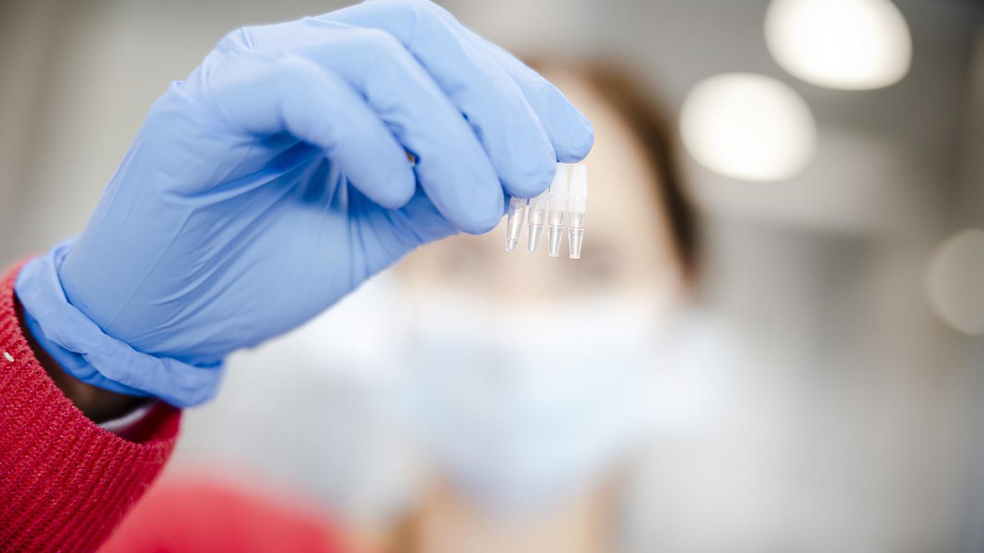 Dagli esiti di 50'783 test è emerso un tasso complessivo di positività del 34,5%.