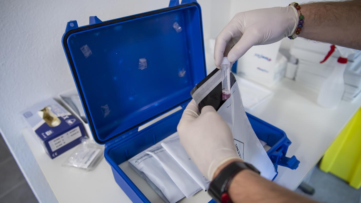 Trasmessi i risultati di 35'038 test, con un tasso di positività al coronavirus del 28%