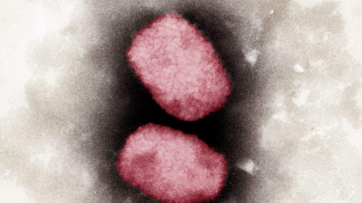 Il virus può essere trasmesso da animali o da uomo a uomo