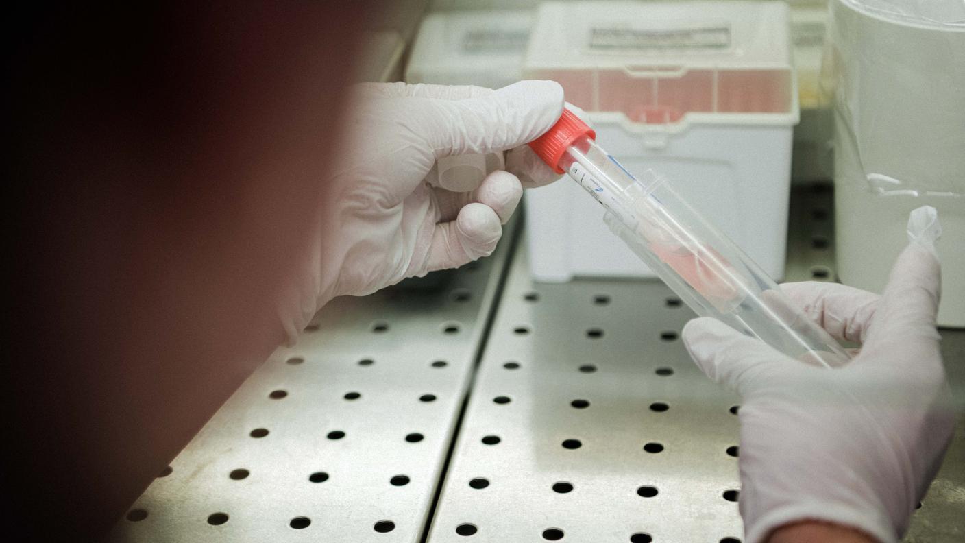 Il provvedimento dovrebbe consentire risparmi annui nella misura di 140 milioni di franchi