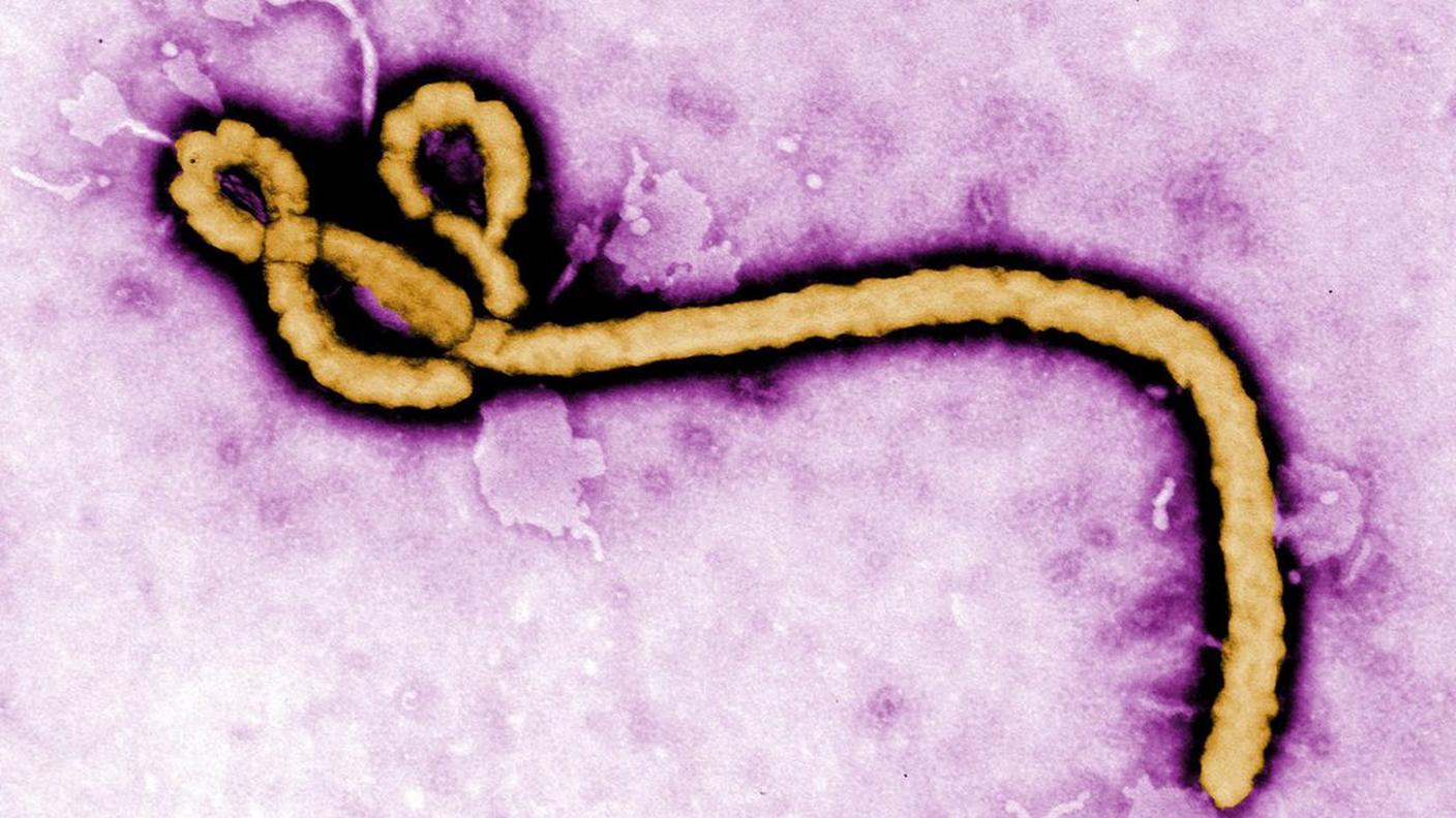 Un'immagine del temibile virus ripresa dal microscopio elettronico