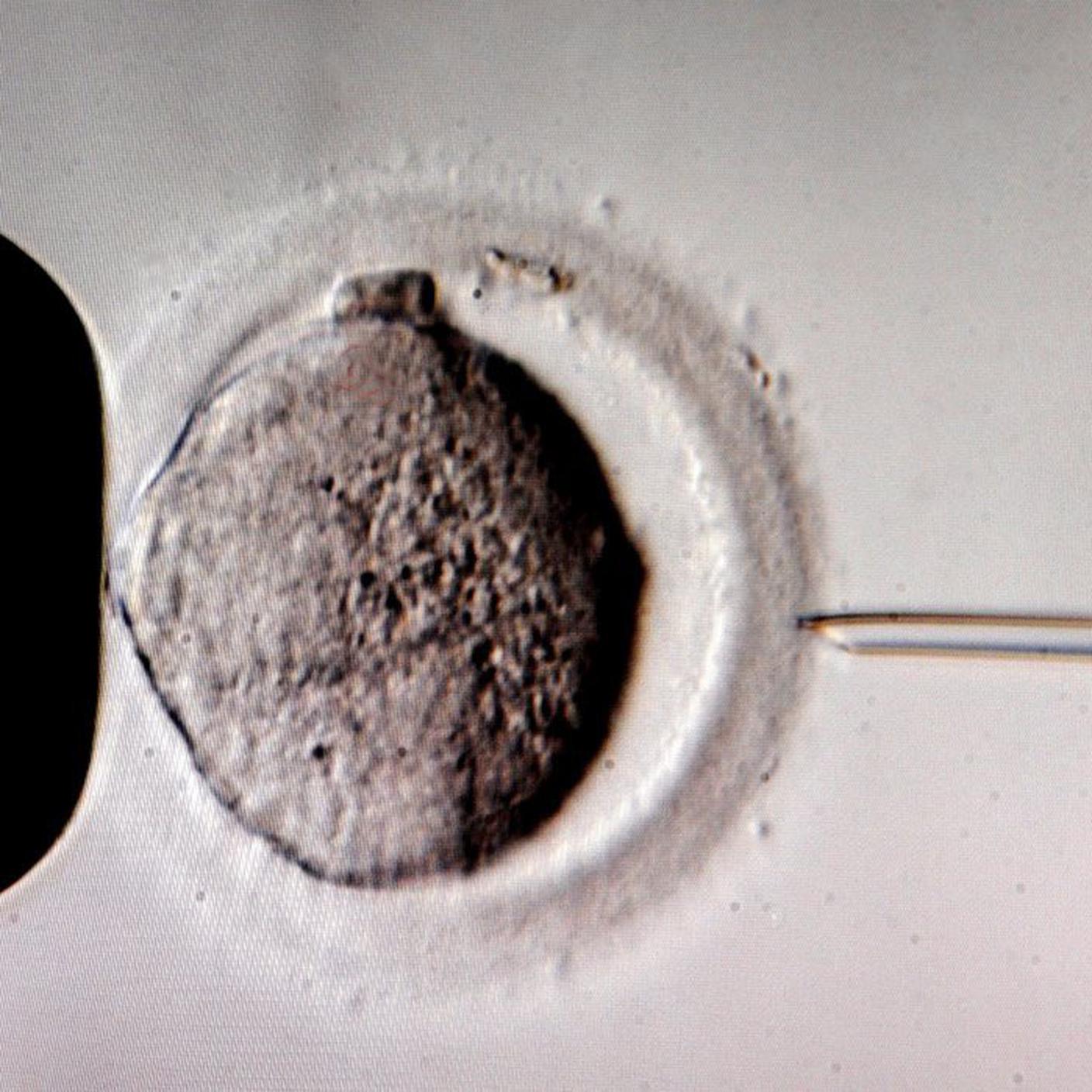 fecondazione in vitro procreazione assistita ky.JPG