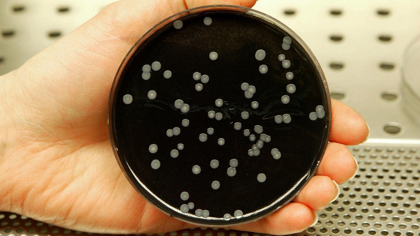 Legionella coltura