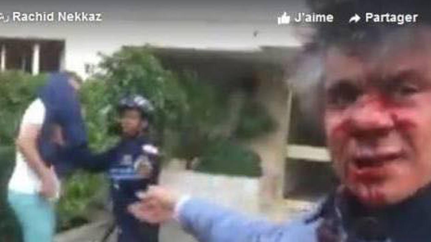 Rachid Nekkaz dopo l'aggressione