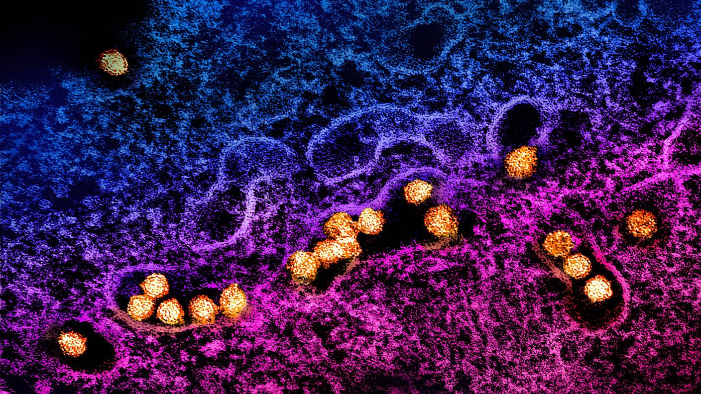 In quest'ingrandimento particelle del WNV, inquadrate nel citoplasma di una cellula