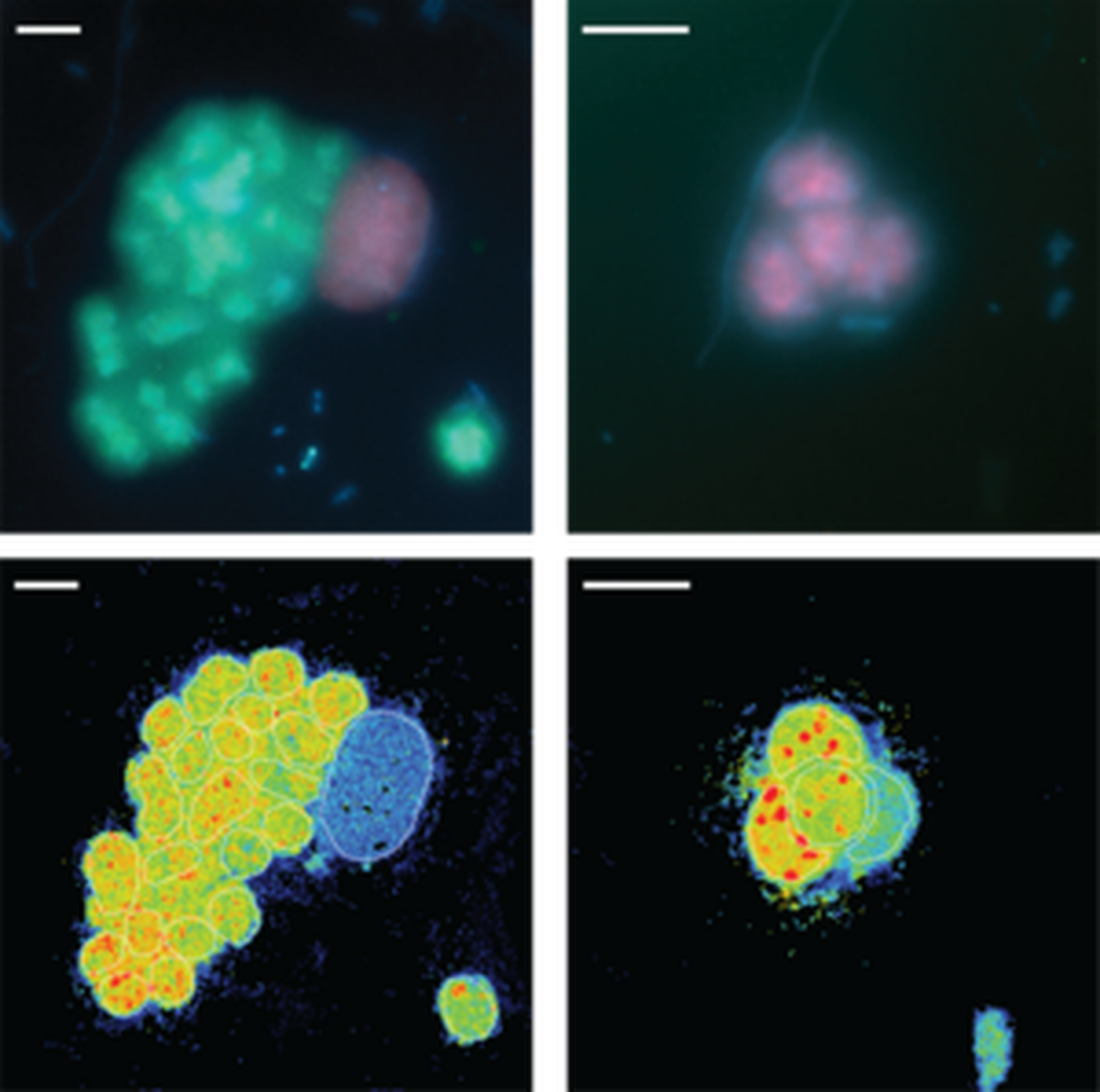 Fluorescenza di batteri di zolfo viola in acqua dolce del lago Cadagno (in verde e viola) e la loro fissazione dell'azoto monocellulare misurata da nanoSIMS (pannelli inferiori)