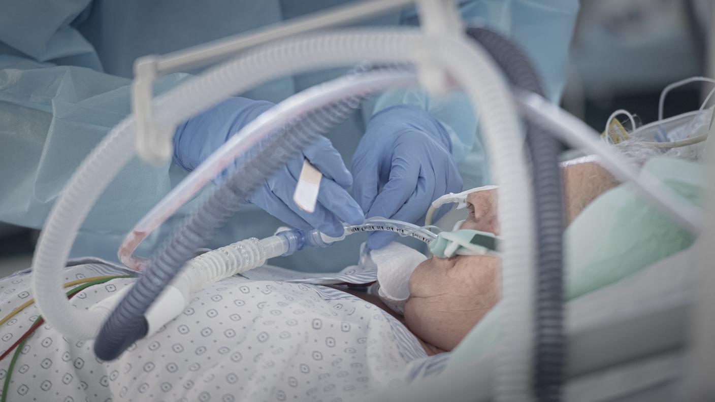 Diminuiscono i pazienti in cure intense