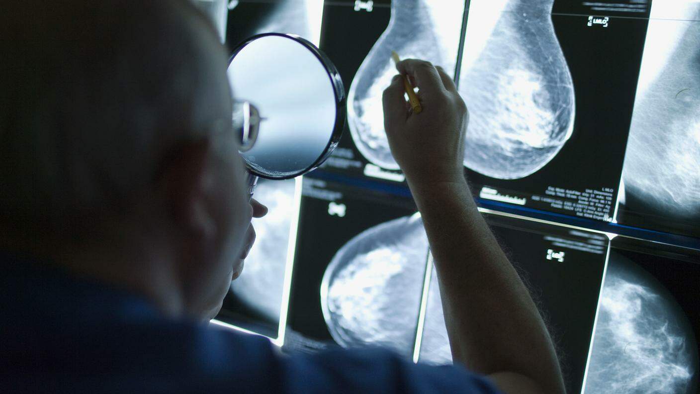In Ticino lo screening mammografico è offerto dal 2015