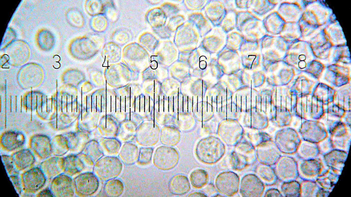 Saccharomyces cerevisiae al microscopio: ogni lineetta rappresenta un micrometro (µm)