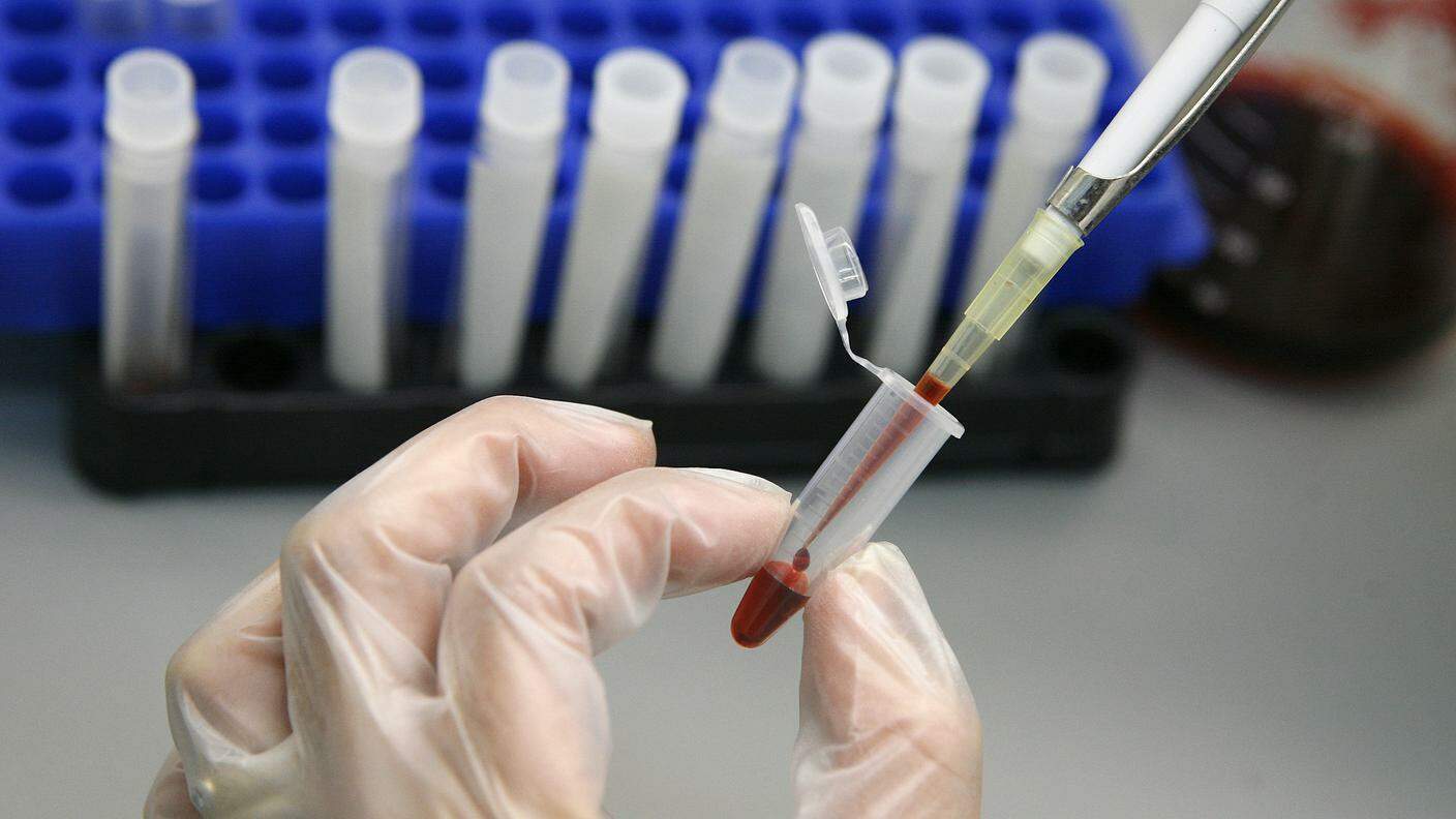 Il vaccino è stato messo a punto dall'équipe di Barbara Ensoli, del Centro per la Ricerca su HIV/AIDS