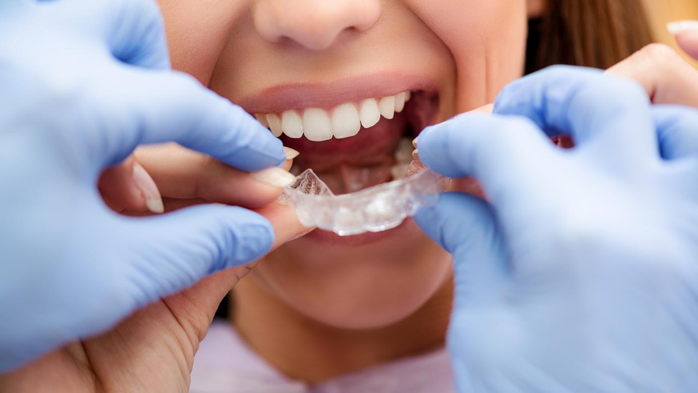 ferule dentista