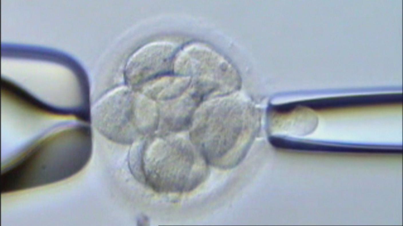 CELLULE IMPIANTO.JPG