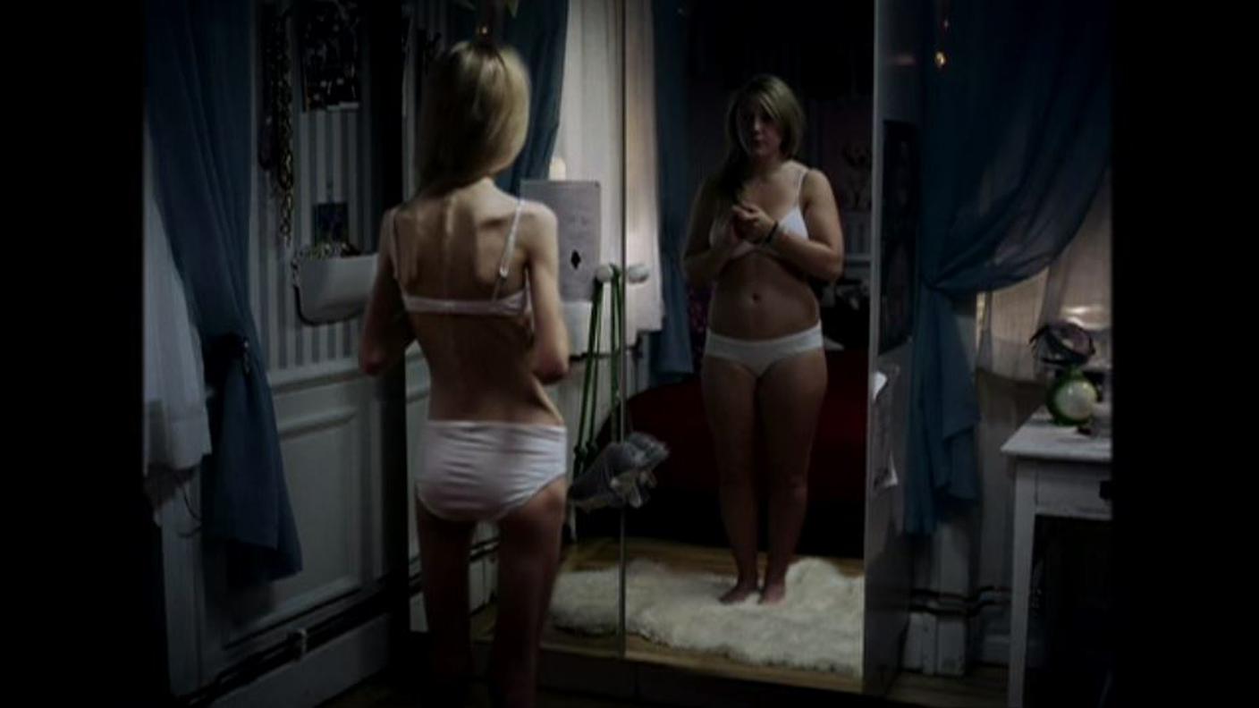 anoressia.JPG