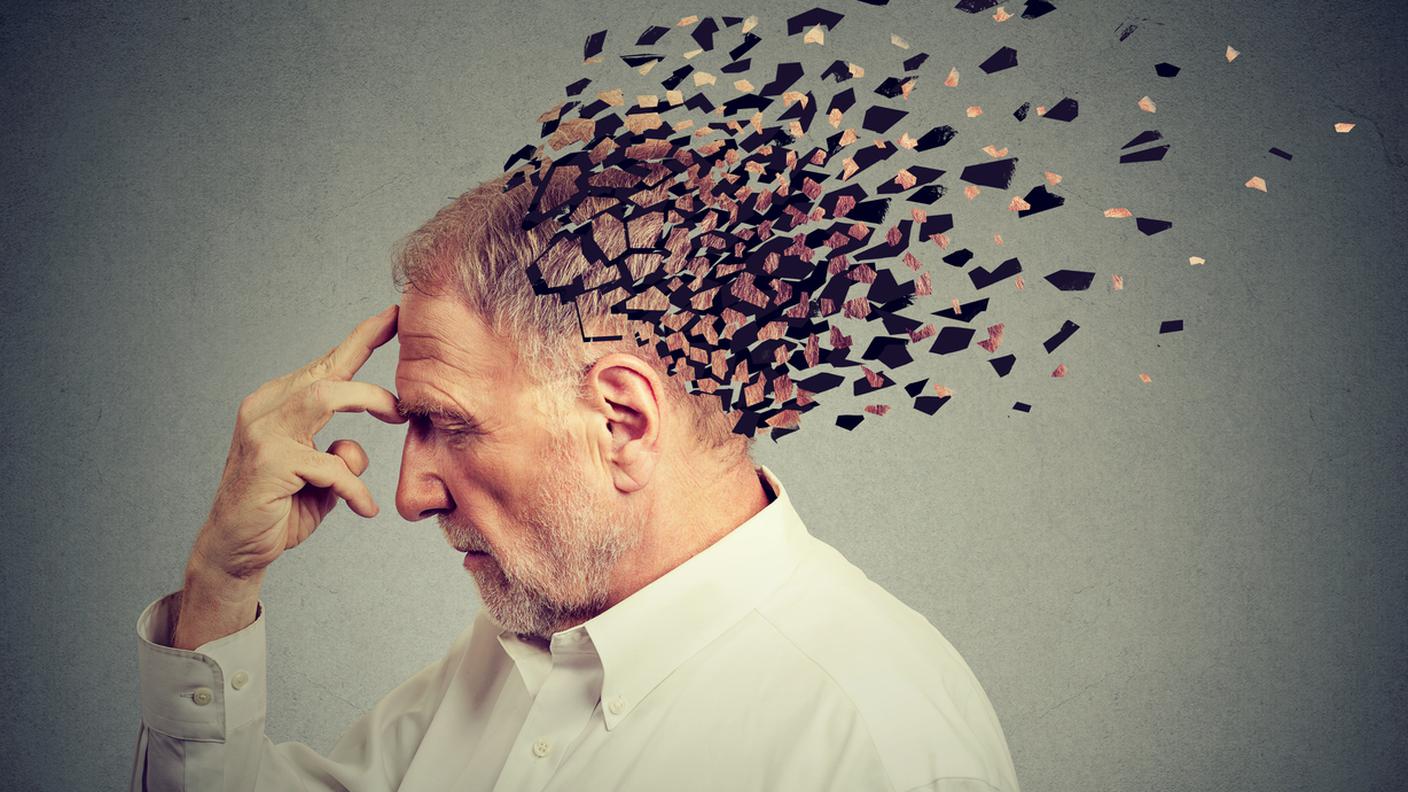 iStock-Stati Uniti d'America, Demenza, Morbo di Alzheimer, Ictus, Cervello umano