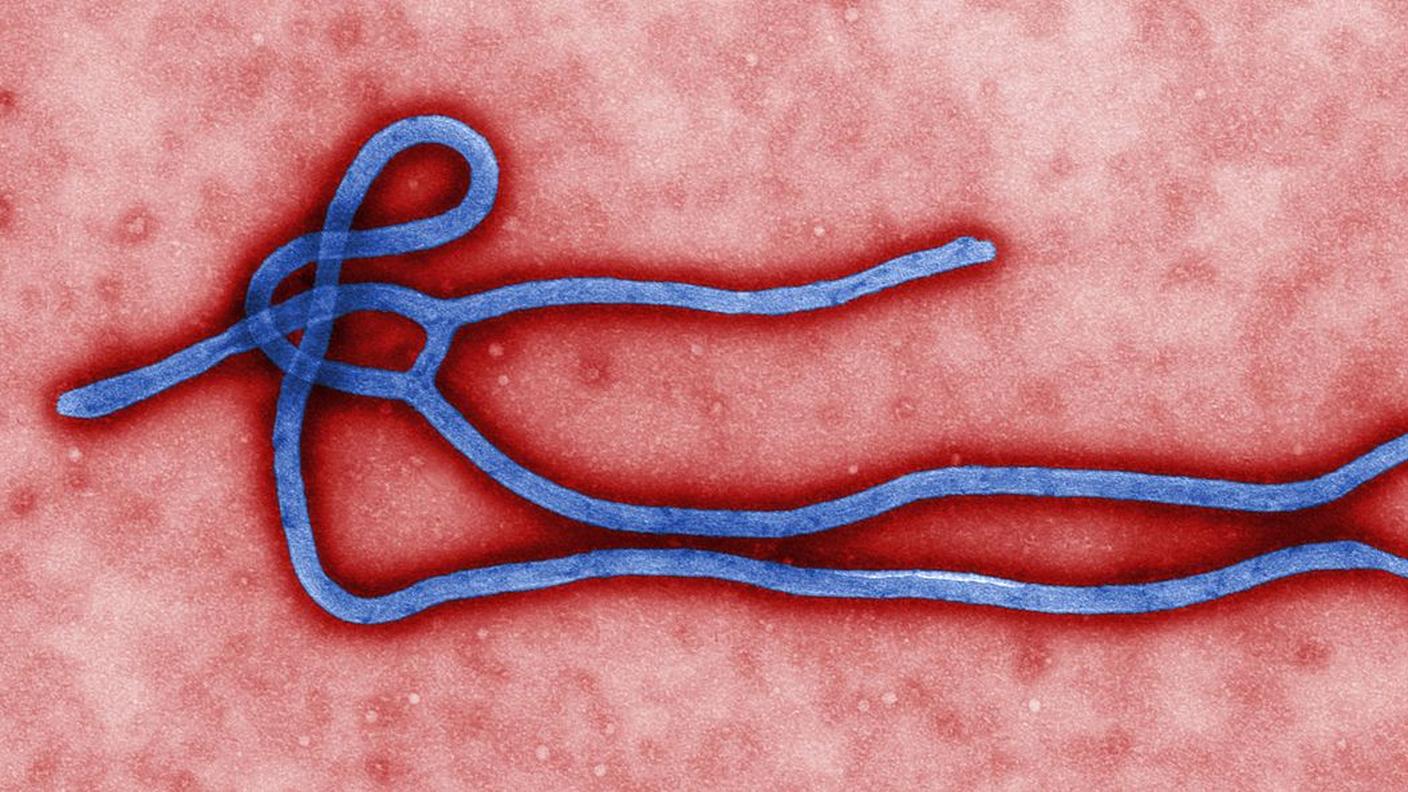 Micrografia dell'Ebola virus, l'unico ceppo dello Zaire ebolavirus, la serie tipo per il genere