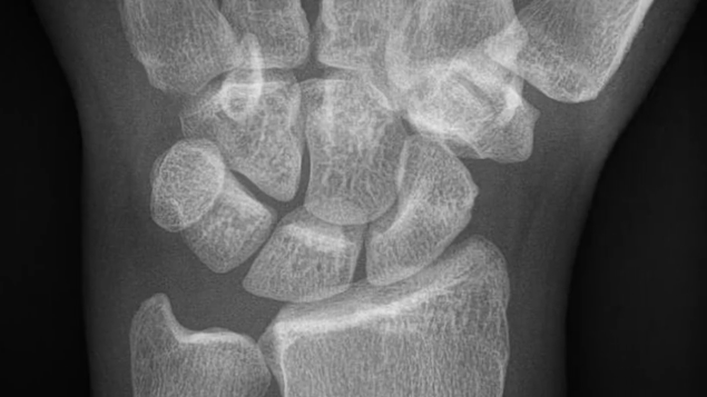 radiografia.png