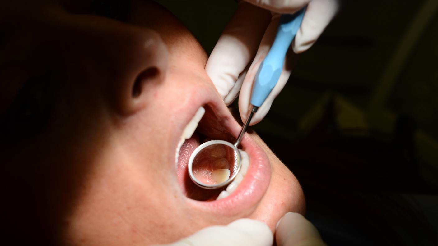 Via il dente via il dolore