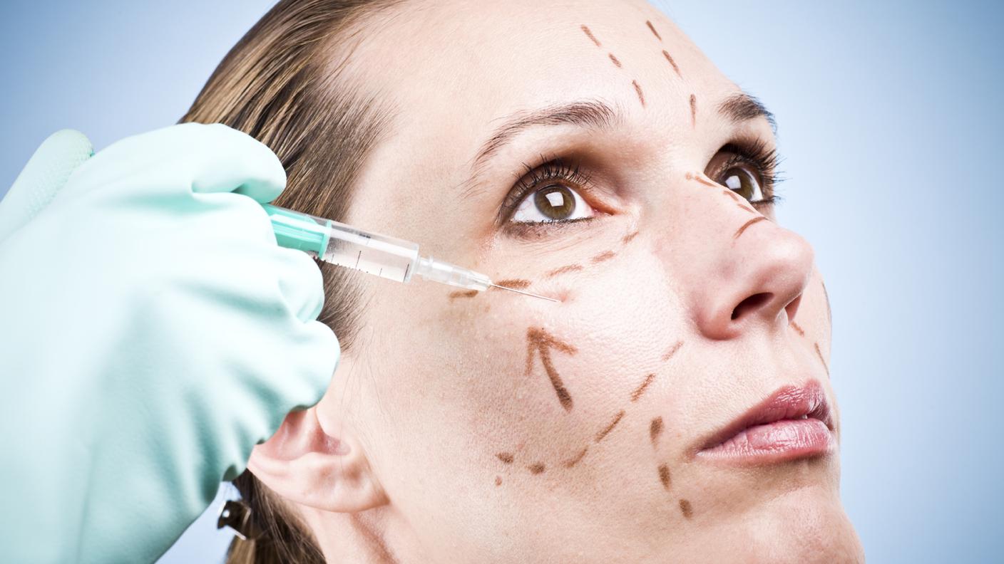 Chirurgia Plastica, Lifting facciale, Viso