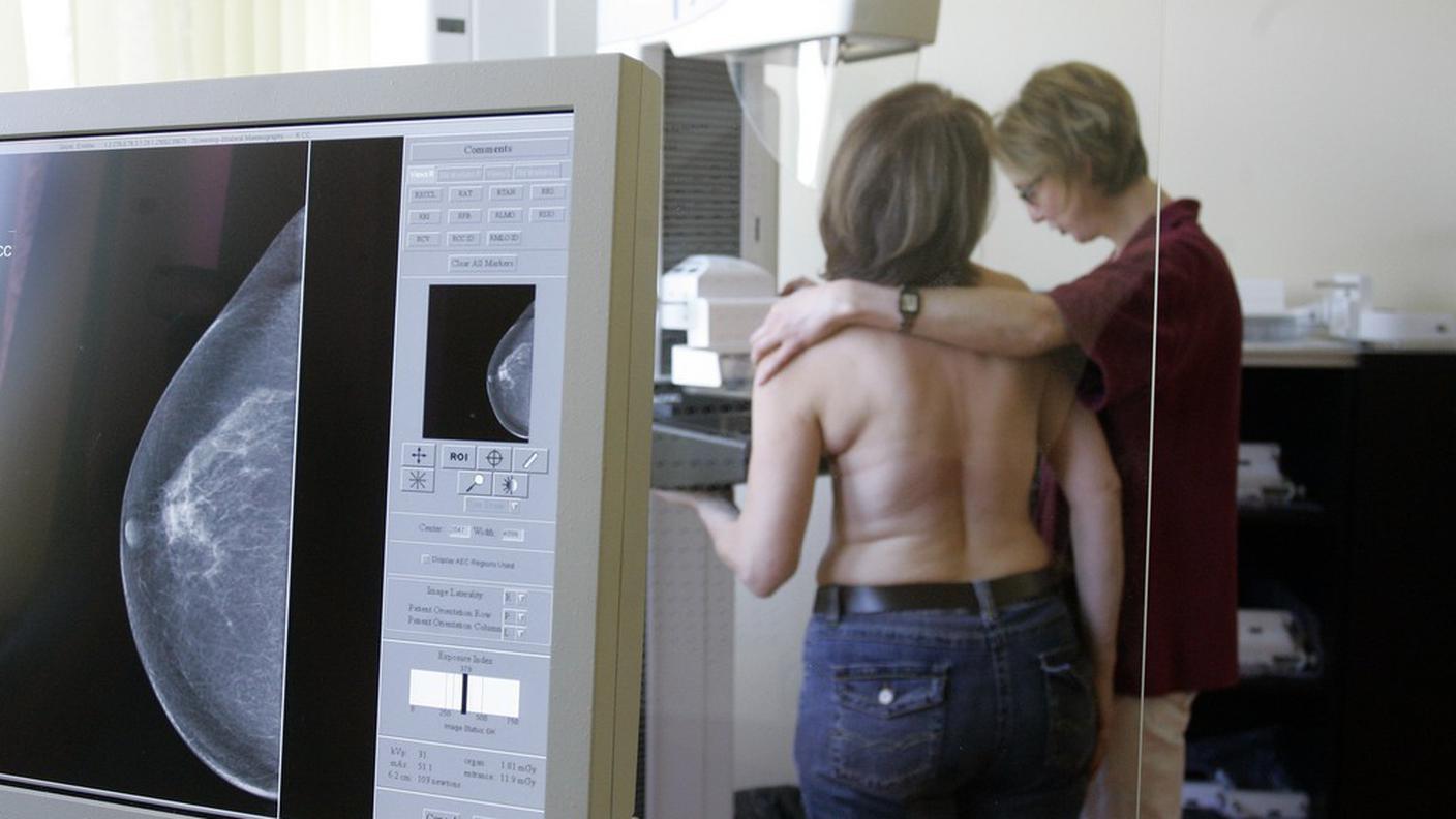 Screening mammografico