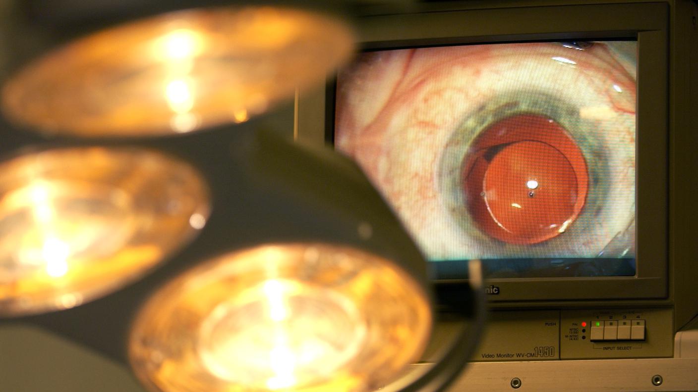Per la prima volta al mondo è stato realizzato un autotrapianto dell'intera superficie oculare