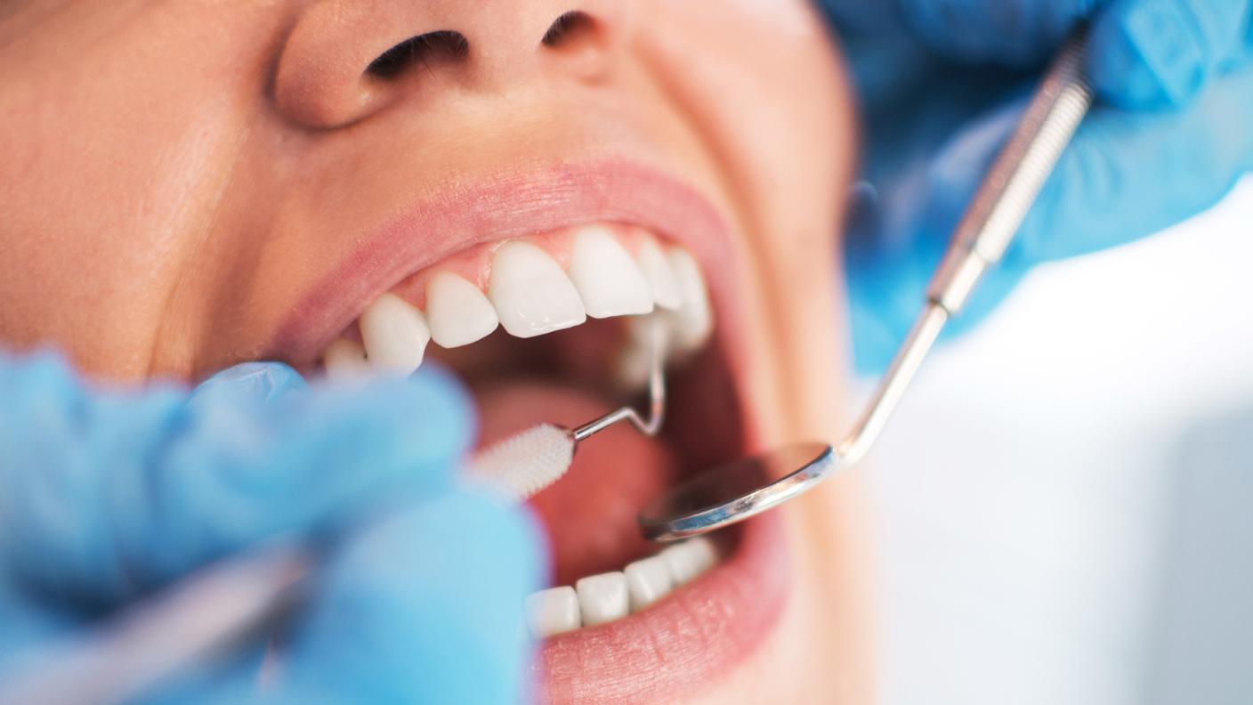 bocca, denti, dentista, igienista