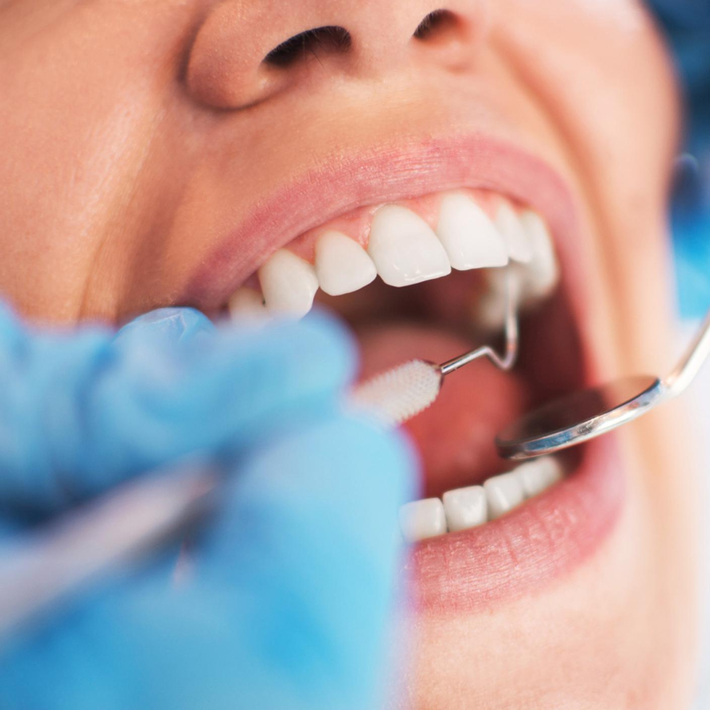 bocca, denti, dentista, igienista