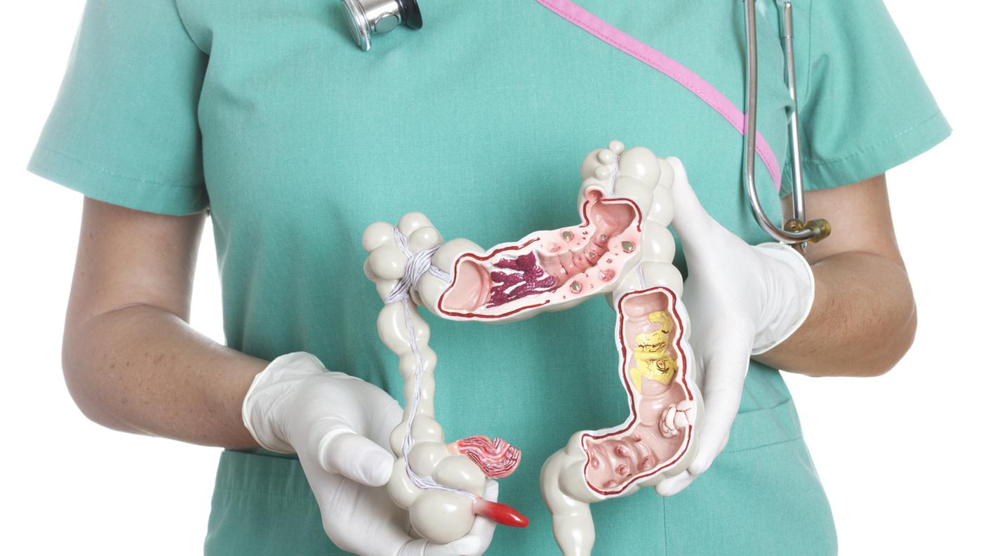 colon, medico, modello