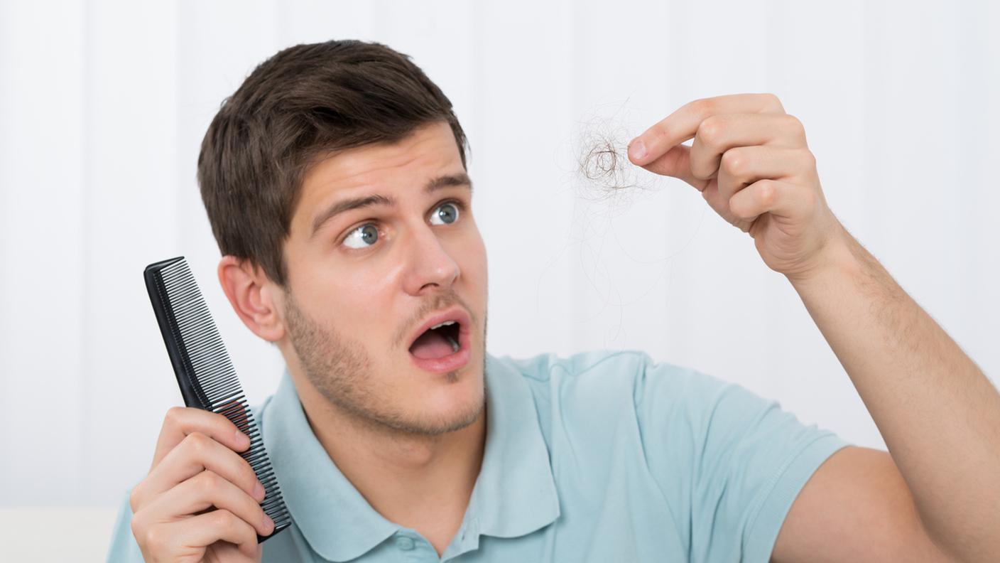 perdita di capelli, uomo