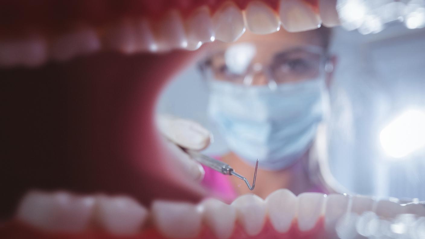 igiene dentale