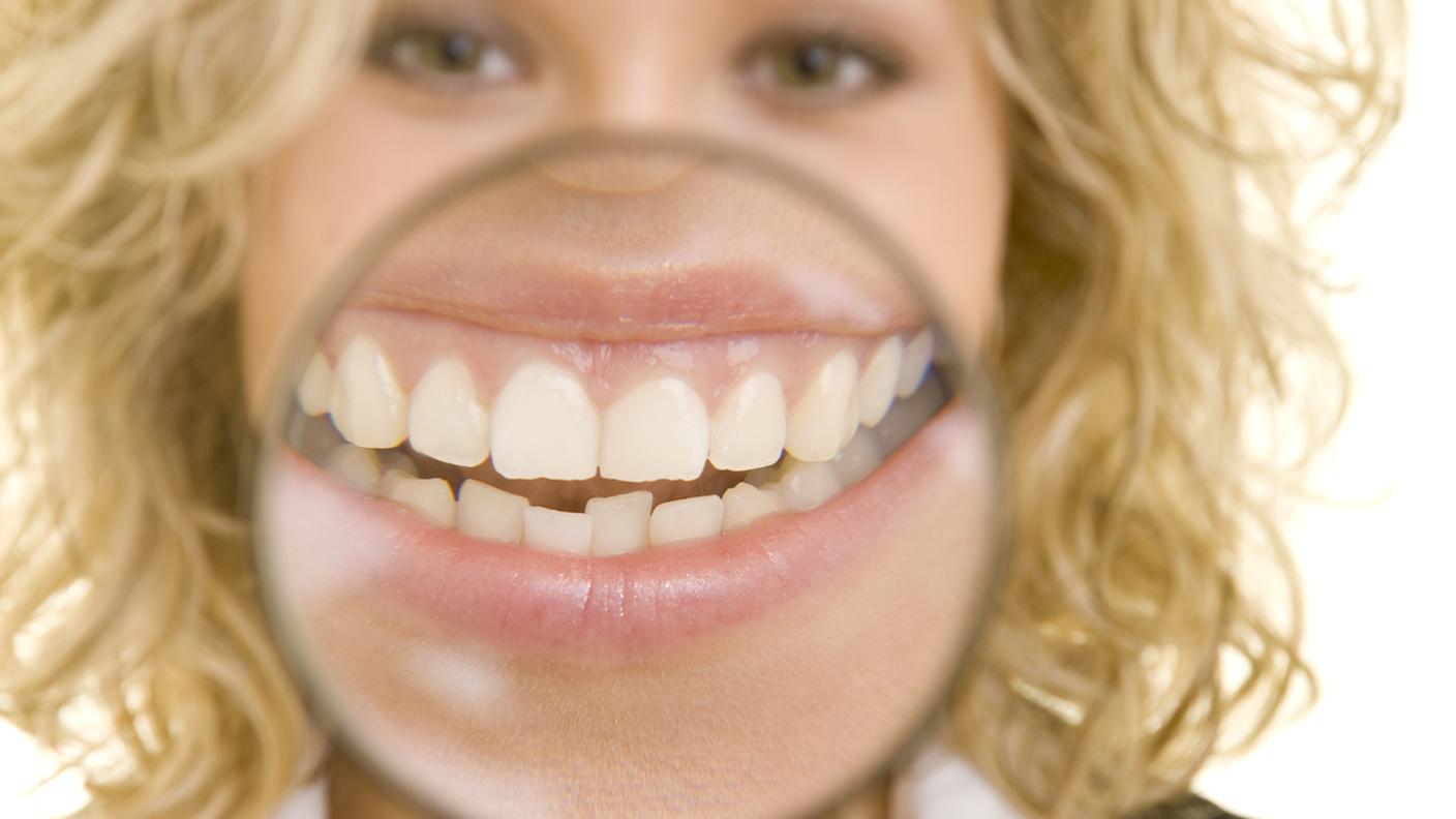 Lente d'ingrandimento, Dentiera, Bocca umana, denti, donna