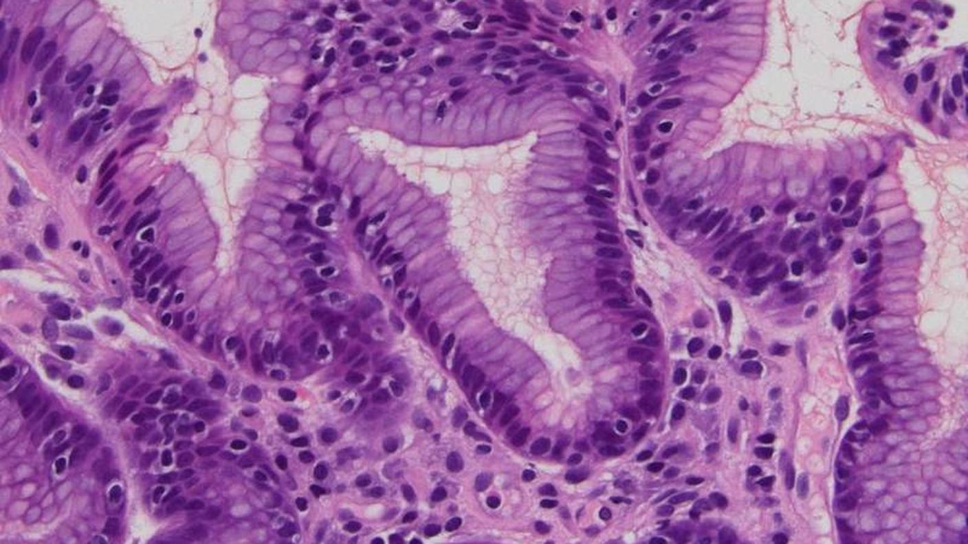 Sezione istologica colorata con Ematossilina-Eosina