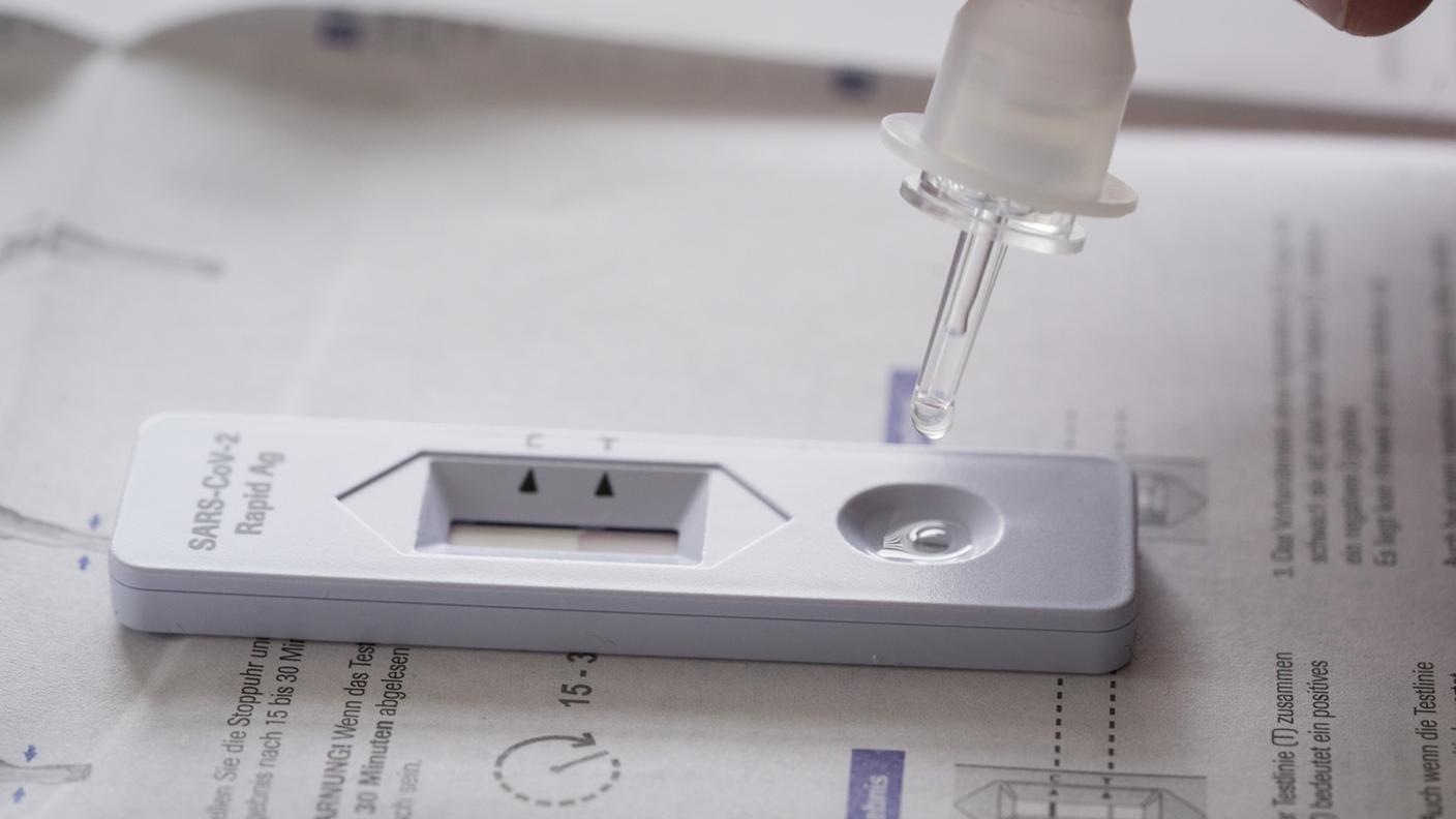 Test Covid, test autodiagnostici del coronavirus