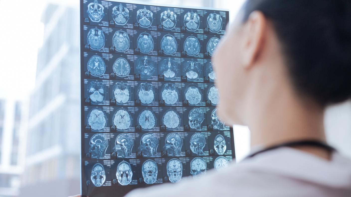 iStock-Ucraina, risonanza magnetica, risonanza magnetica, tomografia computerizzata, scanner medico