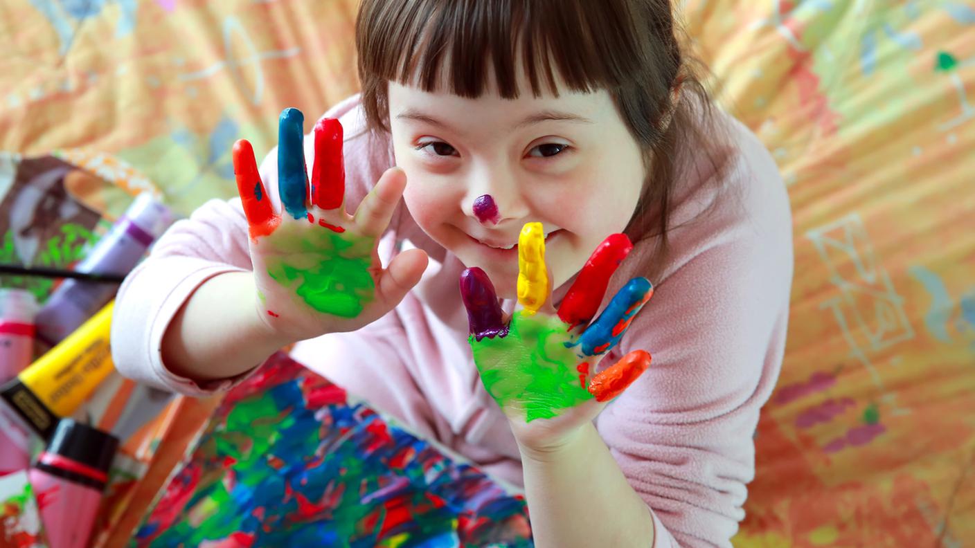 bambina down con mani dipinte, ridere