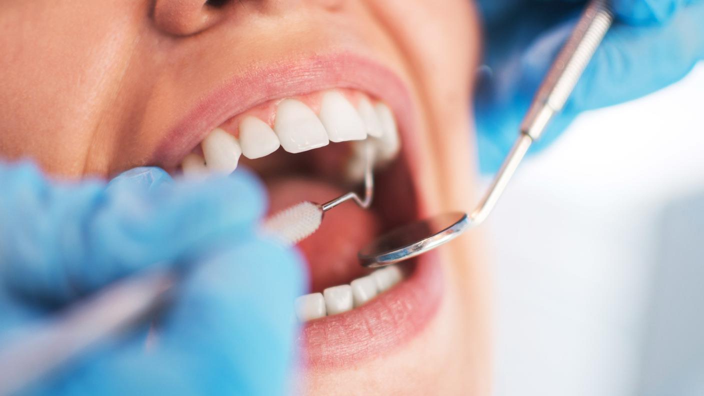 bocca, denti, dentista, igienista