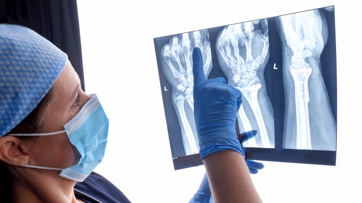 Chirurgo ortopedico che guarda le radiografie, chirurgia della mano