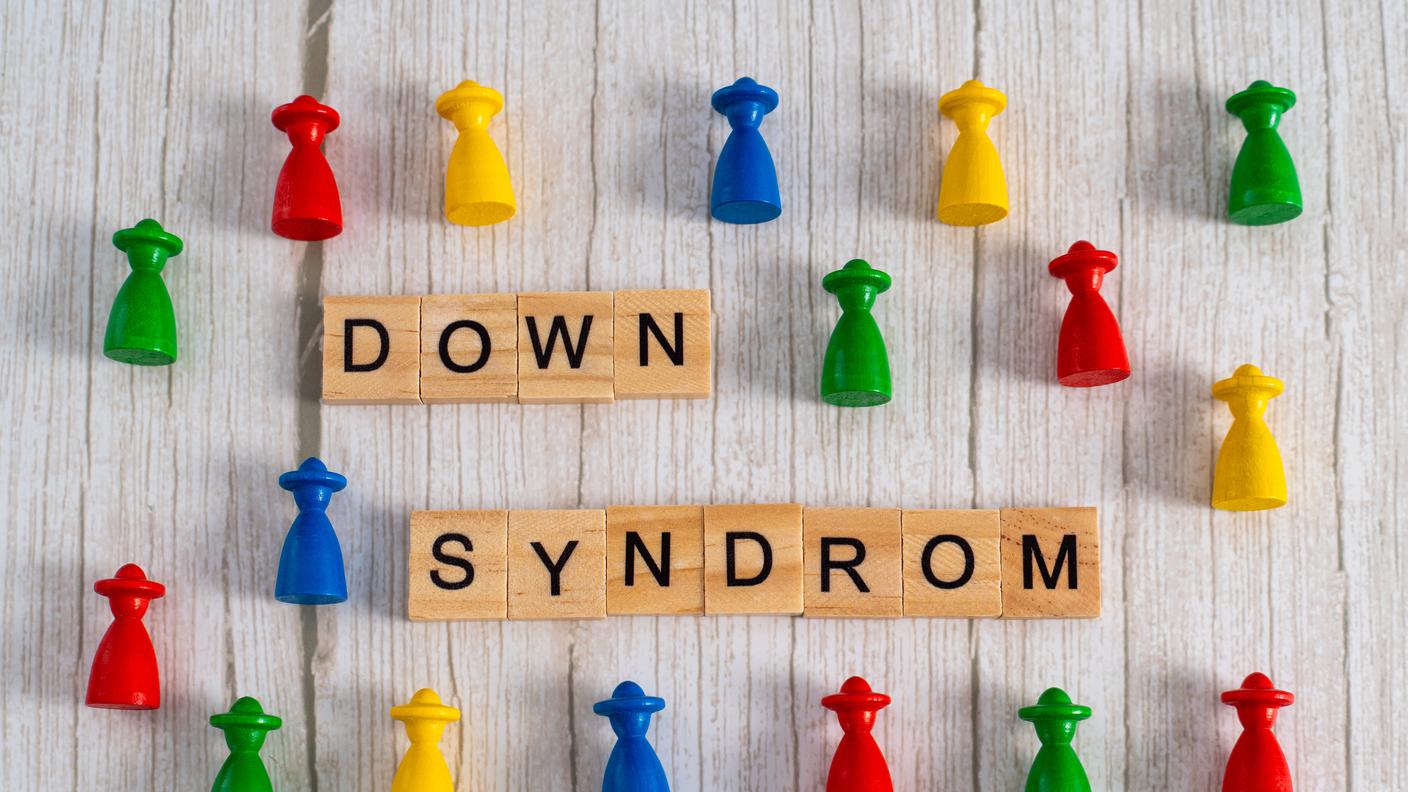 Sindrome di Down