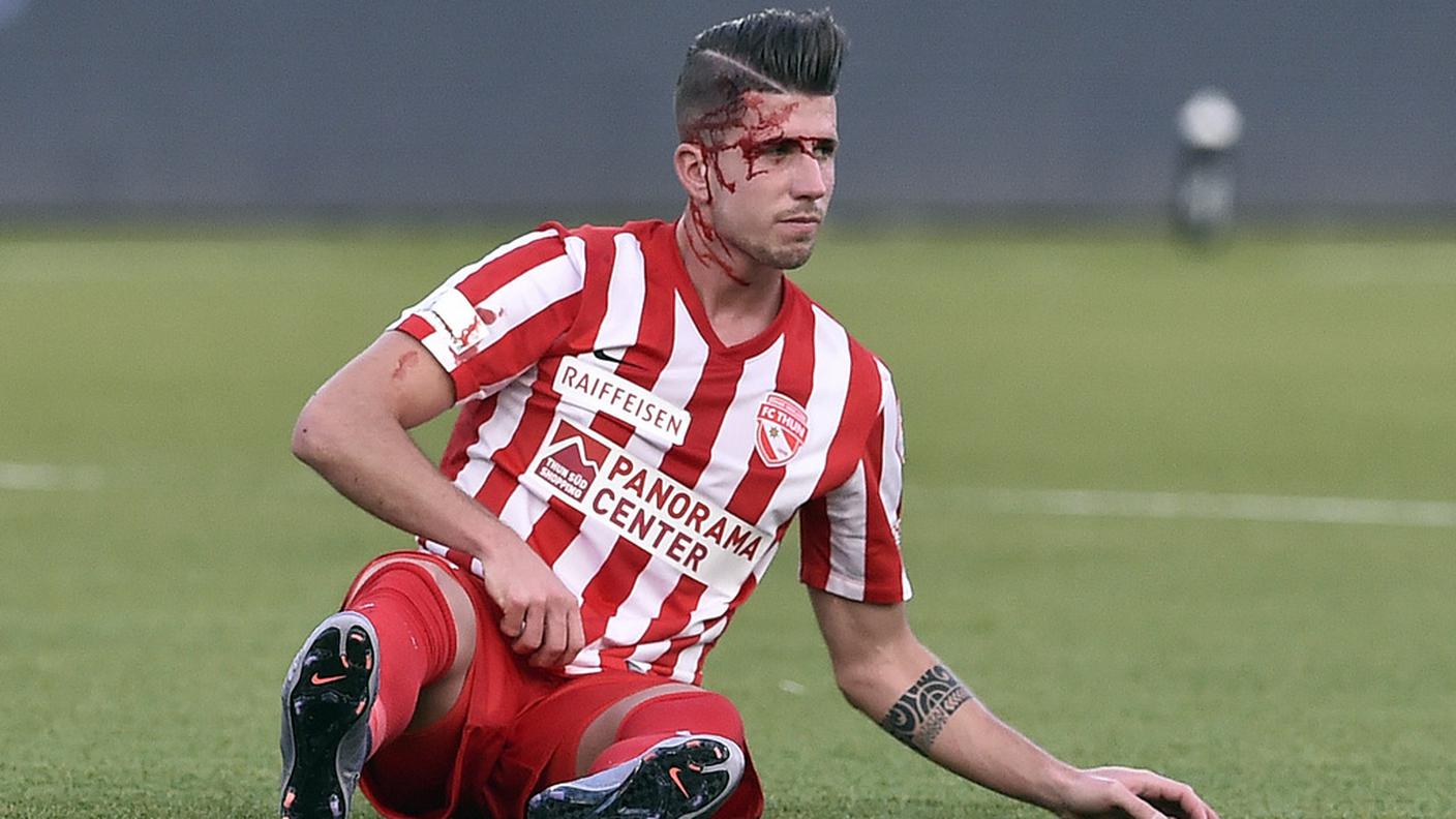 Wieser esce malconcio da un contrasto
