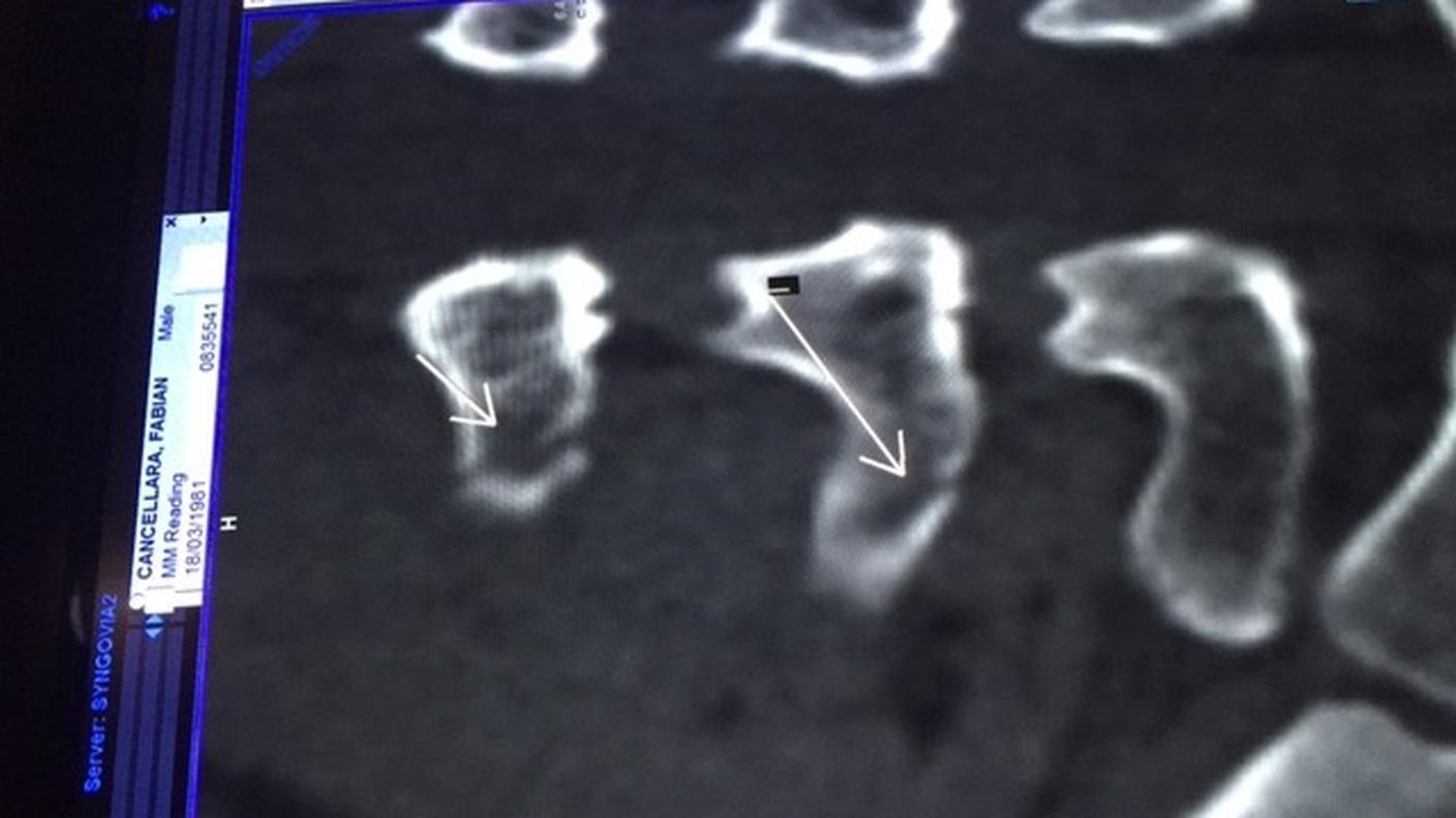 La radiografia